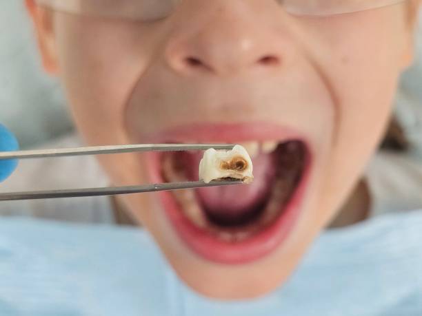 Best Walk-In Emergency Dental Services in Allardt, TN